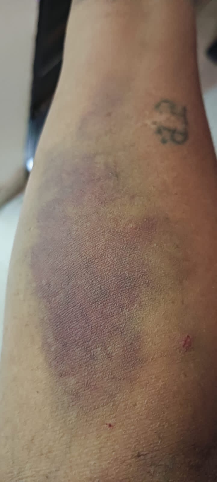 जमकर पीटा-02